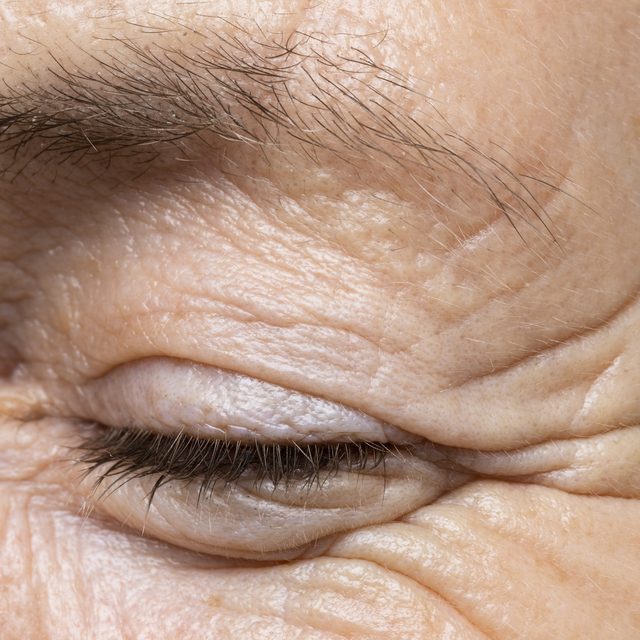 Close-up of skin showing fine lines and wrinkles